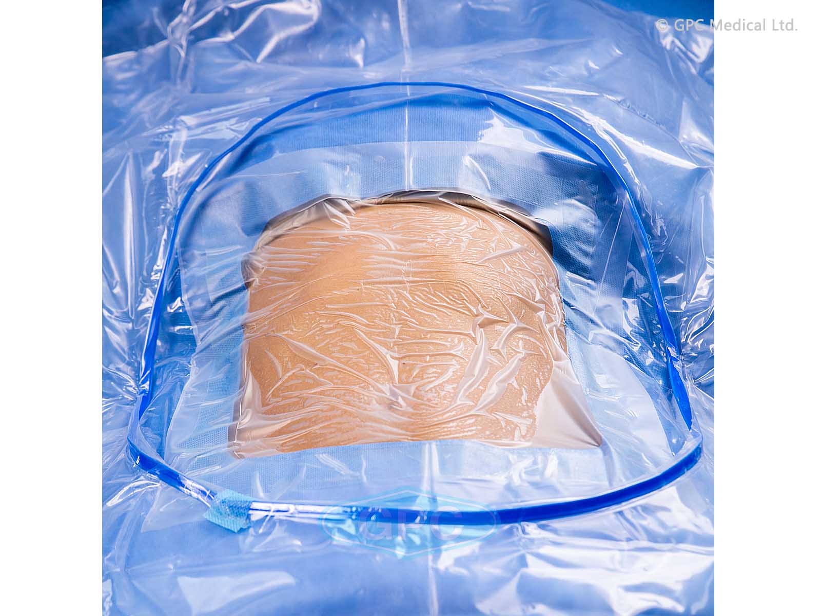 PAÑOS QUIRÚRGICOS PARA LA OPERACIÓN CESÁREA